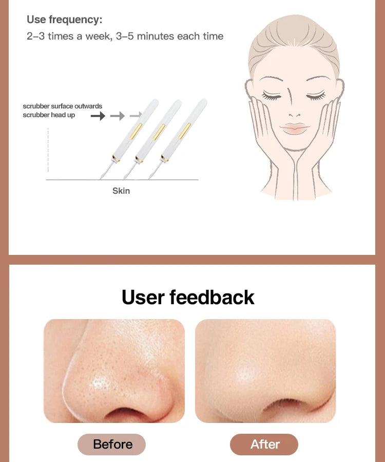 Ultrasonic Skin Scrubber Vibration Face