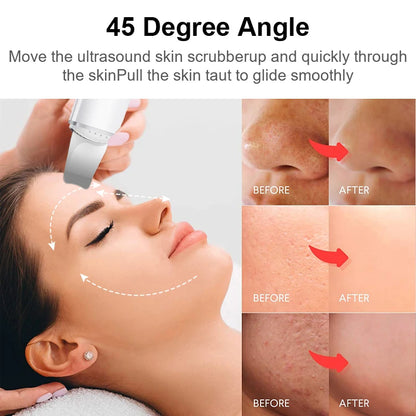 Ultrasonic Skin Scrubber Vibration Face