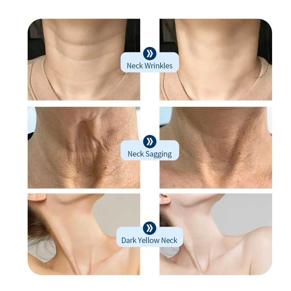 Photon Facial LED Mask
