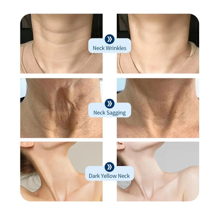 Photon Facial LED Mask